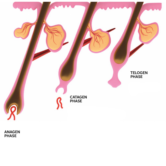 Graphic showing the anagen phase, catagen phase and telogen phase in the hair growth cycle. As the phases progress, the hair fiber starts to move away from the hair follicle.