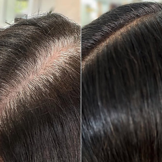 Before and after showing grey hair roots covered with Koleston Perfect.